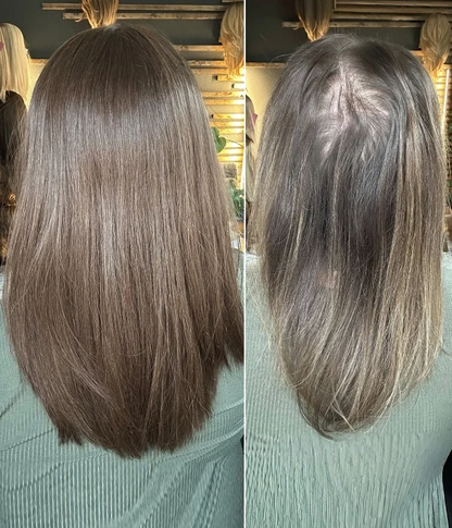 🔥Final Hours—Up to 90% Off🔥Breeze Ultra-Breathable Human Hair Topper
