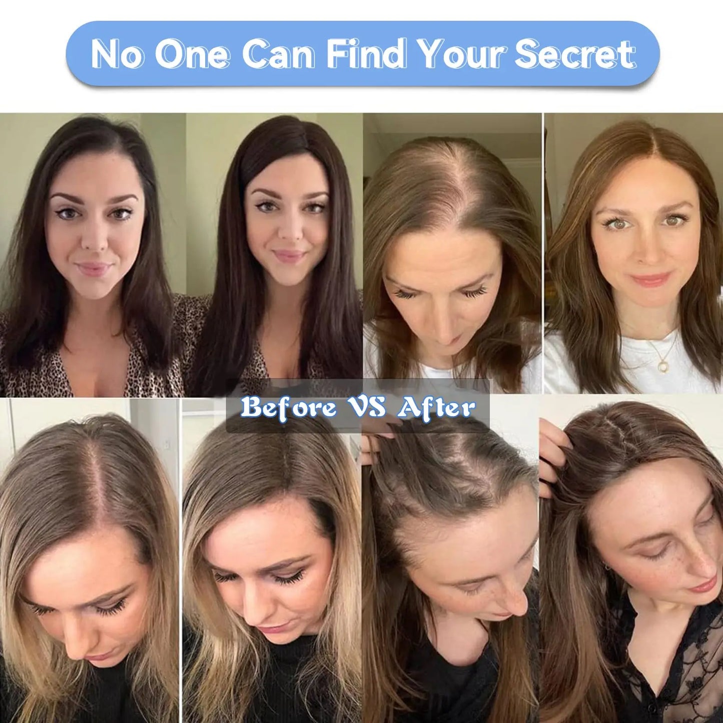 Ombre Ash Blonde Human Hair Topper | Silk Base Remy Hair Topper for Thinning Hair