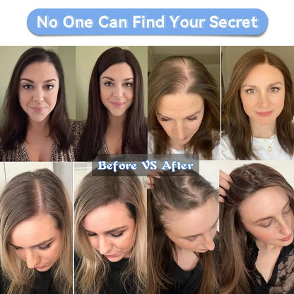 Ombre Ash Blonde Human Hair Topper | Silk Base Remy Hair Topper for Thinning Hair